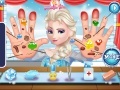 Jogo Frozen Elsa Hand Doctor