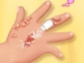 Jogo Dora Hand Doctor